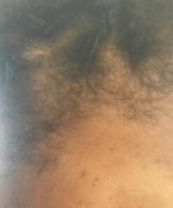 Ultrax Labs Hair Growth Shampoo for Thinning Hair and Hair Loss, Hair Thickening Shampoo, Hair Growth for Women and Men - Hair Surge 8 oz 8 Fl Oz (Pack of 1) - Shampoo 44 61R1cefn4mL