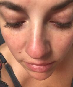 Organic Rosehip Oil – 100% Pure Unrefined Cold Pressed Rosehip Seed Oil - Best Moisturizer for Face, Hair - Great for Fine Lines, Wrinkles, Acne Scars, Sun Damage, Stretch Marks, Eczema, Psoriasis 4 Fl Oz (Pack of 1) 36 61R2nOYXPwL