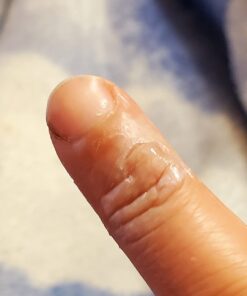 Compound W Maximum Strength Fast Acting Gel Wart Remover, 0.25 oz, 2 Pack unflavored 0.5 Ounce (Pack of 1) 38 61R4kCrDpZL