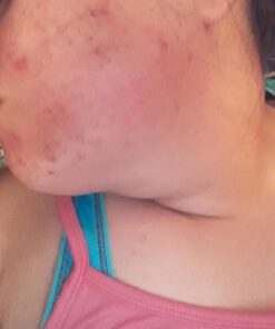 Sky Organics Indian Healing Clay with Detoxifying Bentonite Clay for Face, 100% Pure to Detoxify, Purify & Cleanse, 16 Oz. 1 Pound (Pack of 1) 50 61RHmQZgFBL 2