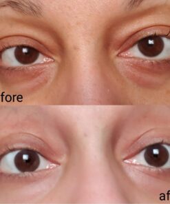 Baebody Eye Gel, Cooling Under Eye Cream For Dark Circles, Puffiness and Bags under Eyes, Eye Cream Anti Aging & Hydrating, Eye Brightening Night Eye Cream - Beauty Gifts for Women 1.7 Fl Oz (Pack of 1) 46 61RICwjTCKL