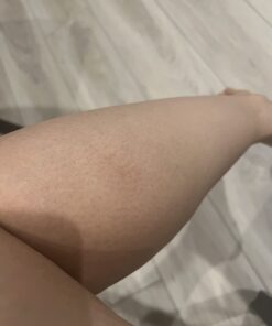 TEA TREE OIL BALM -100% All Natural | Great Cream for Soothing Irritations like Eczema, Psoriasis, Rashes, Insect Bites, Folliculitis, Acne, Itches, Dry Chapped Heels, Cuticles, Saddle Sores and more! 49 61Rk7dyD ZL