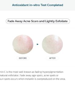 DearKlairs Freshly Juiced Vitamin Drop, 5% Hypoallergenic pure vitamin C serum, 1.18oz | ascorbic acid vitamin c serum, antioxidant serum for face, korean skincare 30 61RpT nLszL