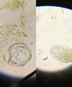 AmScope M150C-I 40X-1000X All-Metal Optical Glass Lenses Cordless LED Student Biological Compound Microscope 64 61S55a4YfwL