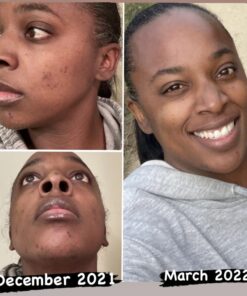 Organic African Black Soap - For Acne & Dark Spots | Natural Vegan and Cruelty Free – Satisfaction Guarantee 1lb bar | 90 day Supply 1 Pound (Pack of 1) 57 61SAYejRFOL