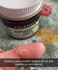 Legend's Creek Farm, Herbal Salve, 20% Ichthammol Drawing Salve, Impurities, Stings, & Splinters, Handmade in USA, 1 Oz Jar (Ichthammol Pine Tar S.) Ichthammol Pine Tar 1 Ounce (Pack of 1) 22 61Sihg9aZLL