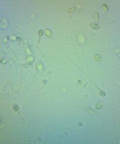 AmScope B120C-E1 40X-2500X LED Biological Binocular Compound Microscope with 3D Double Layer Mechanical Stage + 1.0 MP USB Digital Camera Imager 1.0 MP Camera 37 61TaCPSsjKL