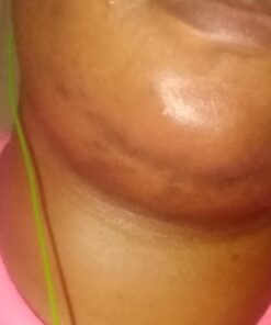 African Black Soap Paste 8 oz. 100% Raw Pure Natural From Ghana. Acne Treatment, Aids Against Eczema & Psoriasis, Dry Skin, Scars and Dark Spots. Great For Pimples, Blackhead, Face & Body Wash. Unscented 8 Ounce (Pack of 1) 64 61TkXtiVlLL