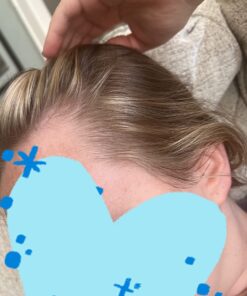 Sports Research Vegan Biotin 10,000mcg with Coconut Oil - Max Strength Biotin Vitamin B7 for Skin and Keratin Support - Non-GMO & Gluten Free, 120 Softgels (4 Month Supply) 120 Count (Pack of 1) 43 61To6O9gqIL