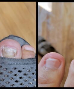 PURELY NORTHWEST-Natural Tea Tree & Peppermint Body Wash for Men & Women-Refreshing Daily Soap for Body Odor & Hygiene, Acne-Effectively Soothes Jock Itch, Chafing & Athletes Foot-Discolored Nails-9oz 9 Fl Oz (Pack of 1) 51 61TxJ21z6BL