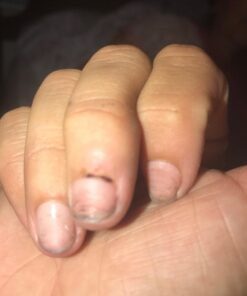 Compound W Nitrofreeze | Wart Removal | 1 Pen & 5 Replaceable Tips 58 61UDaTaUL