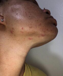 Incredible BY NATURE African Black Soap - 1lb Raw Organic Soap Face & Body Wash 1 Pound (Pack of 1) 37 61USyuvgb L