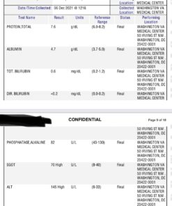 Arazo Nutrition Liver Cleanse Detox & Repair Formula – Milk Thistle Herbal Support Supplement: Silymarin, Beet, Artichoke, Dandelion, Chicory Root 31 61Uz4jrqQwL