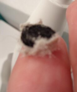 Silk’N Revit - Blackhead Remover Vacuum - Microdermabrasion Machine - Cleansing Exfoliating Face Scrub Pore Vacuum 41 61V70pAY DL