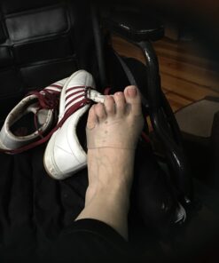 Askilt Gel Metatarsal Cushion Pads, Toe Separators Bunion Splint Pads for Hallux Valgus, Hammer Toe, Forefoot Pads,Gel Metatarsal Pad Breathable for Mortons Neuroma White 34 61VSRZZWvOL