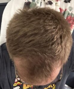 Nutrafol Men's Hair Growth Supplements, Clinically Tested for Visibly Thicker Hair and Scalp Coverage, Dermatologist Recommended - 1 Month Supply 56 61VjiZULZL