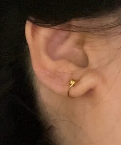 SkinSmart Antimicrobial Eczema Therapy with Hypochlorous Acid, Removes Bacteria so Skin Can Heal, for Adults, Kids and Seniors, 8 Ounce Clear Spray 8 Fl Oz (Pack of 1) 45 61XFWWKMtL