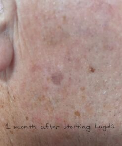 J.CROW'S® Lugol's Solution of Iodine 2% 2oz Unflavored 2 Ounce (Pack of 1) 31 61XiZUEy7kL