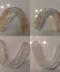 iSonic F3900 Ultrasonic Denture/Aligner/Retainer Cleaner for all dental and sleep apnea appliances, 110V 20W (tank no longer removable) , White , 0.4Pt/0.2L 01.F3900, AC110V 54 61XvKhtyKLL