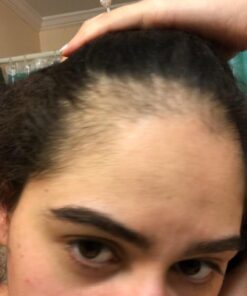 Hairburst Hair Growth Shampoo & Conditioner Set For Women - Vegan Shampoo for Anti Hair Loss & Thinning Hair 33 61YDiByP6pL