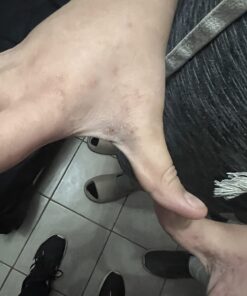 Aidance Skincare & Topical Solutions terrasil Anti-fungal Treatment MAX - 50g 35 61YTYrRlulL