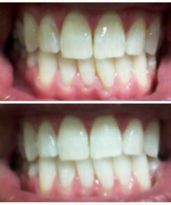 Crest 3D Whitestrips, Glamorous White, Teeth Whitening Strip Kit, 28 Strips (14 Count Pack) Flavorless 28 Count (Pack of 1) 39 61YVDwttuCL