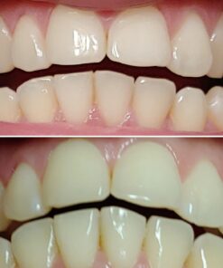 Crest 3D Whitestrips, Glamorous White, Teeth Whitening Strip Kit, 28 Strips (14 Count Pack) Flavorless 28 Count (Pack of 1) 37 61YgMEQMC1L