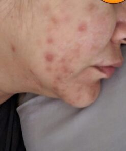 DIM Supplement 200 mg | Estrogen Hormone Balance for Women & Men | Hormonal Acne Supplements, Menopause Support, Antioxidant Support | Clean Label Project Certified, Vegan, Soy Free | 60 Ct. DIM 200mg 51 61Z Yd96sL 1