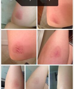 artnaturals Tea Tree Essential Oil 4oz - 100% Pure Oils Premium Melaleuca Therapeutic Grade Best for Acne, Skin, Hair, Nails, Face and Body Wash Aromatherapy & Diffuser 45 61ZRWSkLjML