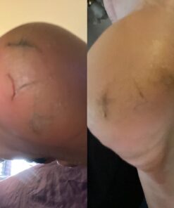 Kerasal Intensive Foot Repair, Skin Healing Ointment for Cracked Heels and Dry Feet, 1 Oz 36 61Zw20em5ML