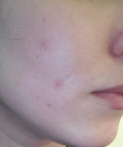 Paulas Choice--SKIN PERFECTING 2% BHA Liquid Salicylic Acid Exfoliant--Facial Exfoliant for Blackheads, Enlarged Pores, Wrinkles & Fine Lines, 4 oz Bottle 4.00 Fl Oz (Pack of 1) 36 61b7y45gNXL