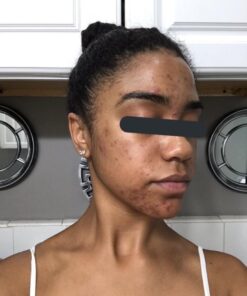 Organic African Black Soap - For Acne & Dark Spots | Natural Vegan and Cruelty Free – Satisfaction Guarantee 1lb bar | 90 day Supply 1 Pound (Pack of 1) 52 61bRqBWLIlL