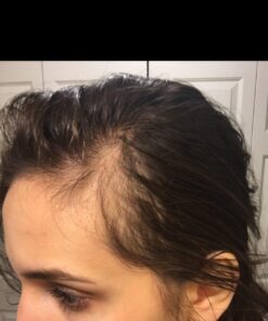 Saw Palmetto & Cayenne Scalp Oil For Hair Growth, Hair Loss Serum, Hair Oil For Dry Damaged Hair And Growth, Hair Growth Serum For Thicker Longer Fuller Healthier Hair, All Natural Vitamin Rich 35 61bdQu0MRgL