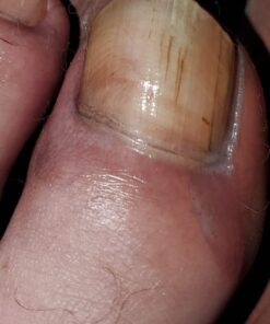 Aidance Skincare & Topical Solutions terrasil Anti-fungal Treatment MAX - 50g 30 61bkTN38gL