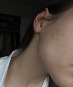 SeoulCeuticals Korean Skin Care 20% Vitamin C Hyaluronic Acid Serum + CE Ferulic Acid - Potent Anti Aging, Anti Wrinkle Korean Beauty 1oz 51 61c3HDjOtaL