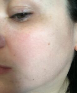 Hydrating Face Moisturizer & Body Cream with Manuka Honey Cream - Organic Face Moisturizer & Body Lotion for Extremely Dry Skin - For Dry & Itchy Skin, Rosacea & Eczema Prone Skin (Original, 2oz) Original 2 Ounce (Pack of 1) 39 61c4M0siFSL