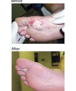 Dr. Nordyke's Wound Honey New Zealand Manuka Honey for Infections,Burns,Cuts and Scars (80g) 2.8 Ounce (Pack of 1) 17 61cVs7ia7cL