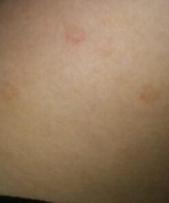 PURELY NORTHWEST-Natural Tea Tree & Peppermint Body Wash for Men & Women-Refreshing Daily Soap for Body Odor & Hygiene, Acne-Effectively Soothes Jock Itch, Chafing & Athletes Foot-Discolored Nails-9oz 9 Fl Oz (Pack of 1) 63 61cgMKQyfFL