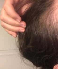 Saw Palmetto & Cayenne Scalp Oil For Hair Growth, Hair Loss Serum, Hair Oil For Dry Damaged Hair And Growth, Hair Growth Serum For Thicker Longer Fuller Healthier Hair, All Natural Vitamin Rich 41 61dIy8ufjBL