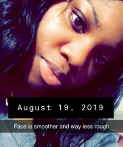 Neutrogena Oil-Free Acne Face Scrub, 2% Salicylic Acid Acne Treatment Medicine, Daily Face Wash to help Prevent Breakouts, Oil Free Exfoliating Facial Cleanser for Acne-Prone Skin, 4.2 fl. oz Unscented 4.2 Fl Oz (Pack of 1) 42 61da4xy9IqL