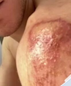 Band-Aid Brand Hydro Seal Adhesive Hydrocolloid Gel Bandages for Wound Care & Blister Relief, All Purpose Waterproof & Shower Proof Blister Pad, Sterile & Long-Lasting, Extra Large, 3 ct 3 Count (Pack of 1) 46 61dq3XxDRWL