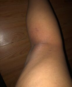 Organic Aloe Vera Gel - 100% Pure for Skin, Sunburn Relief & Face Moisturizer - Extracted from Aloe Vera Plant with Manuka Honey, Orchid & Apple Stem Cells - Everyday Use - 8 Fl Oz 8 Fl Oz (Pack of 1) 41 61dvNp3TymL 1