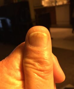 Kerasal Nail Renewal, Restores Appearance of Discolored or Damaged Nails, 0.33 fl oz (Packaging May Vary) 38 61eAnoJVFqL