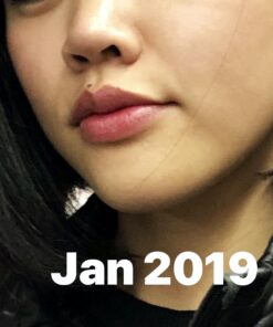 Estroblock PRO Triple Strength - 60 Capsules, DIM & Indole 3-Carbinol for Natural Hormonal Hormone Balance, Acne - Anti Toxic Estrogen Aromatase Inhibitor Blocker. Soy Free, Dairy Free, Non-GMO (1) 1 65 61euAkLWEsL 4