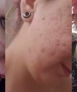 Tree of Life Retinol Serum for Face w/Hydrating Hyaluronic Acid for Wrinkle Soothing, Fine Lines & Dark Spots - 2 Fl Oz - Renew & Reset Nighttime Serums - Dermatologist Tested Facial Skin Care 2 Fl Oz (Pack of 1) 45 61gHh2QOy1L