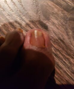 Fungi Nail Anti-Fungal Ointment, Kills Fungus That Can Lead to Nail & Athlete’s Foot with Tolnaftate & Clinically Proven to Cure Infections, Natural Color, 0.7 Fl Oz 33 61gSlldZjrL