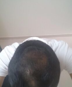 WICK & STRÖM Hair Loss Vitamins - 2 Month Supply - DHT Blocker Support- With Saw Palmetto Hair Growth Support Rich in Biotin - (Wick & Strom Hair Loss Products for Men and Women) 33 61hSxrIqfDL 1