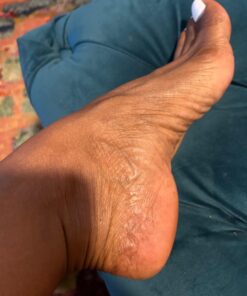 Kerasal Intensive Foot Repair, Skin Healing Ointment for Cracked Heels and Dry Feet, 1 Oz 41 61hTahxrfPL