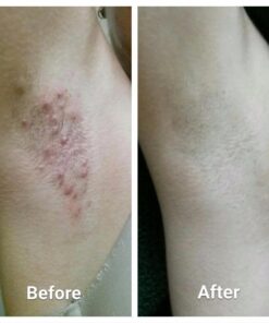 Tend Skin Razor Bump Solution, 4 ounce, Post Shaving & Waxing, for women & men 57 61hpusdUtL