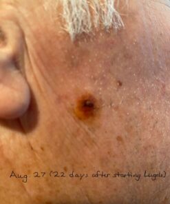 J.CROW'S® Lugol's Solution of Iodine 2% 2oz Unflavored 2 Ounce (Pack of 1) 32 61hqnWIUeL